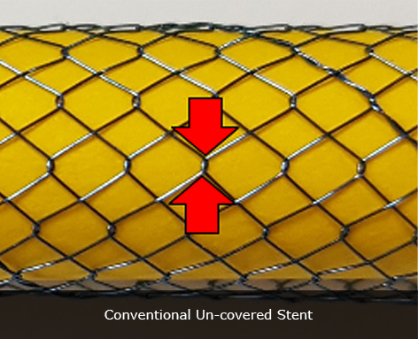 Conventional Un-covered Stent
