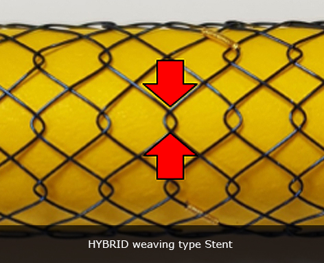 HYBRID weaving type Stent
